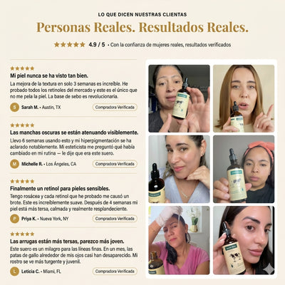 👑 Woodsleep™ Golden Micro-Peptide Serum  ✨ Suero Facial Avanzado con Micropéptidos Dorados para una Piel Más Firme, Radiante y de Apariencia Renovada