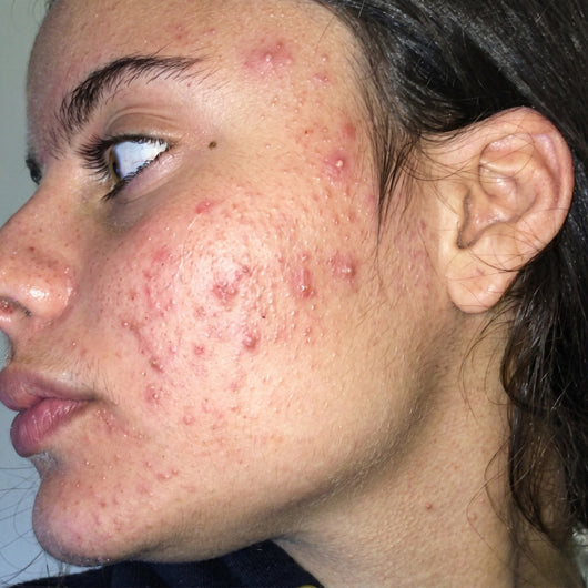 👑 Woodsleep™ Golden Micro-Peptide Serum  ✨ Suero Facial Avanzado con Micropéptidos Dorados para una Piel Más Firme, Radiante y de Apariencia Renovada