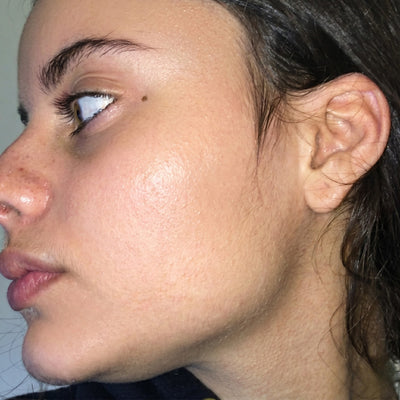 👑 Woodsleep™ Golden Micro-Peptide Serum  ✨ Suero Facial Avanzado con Micropéptidos Dorados para una Piel Más Firme, Radiante y de Apariencia Renovada
